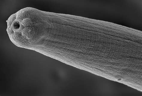 Parasitic Worm Venom Evades Human Immune System News