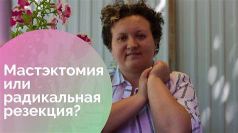 Мастэктомия или радикальная резекция? - YouTube Картинка - Мастэктомия или радикальная резекция? - YouTube