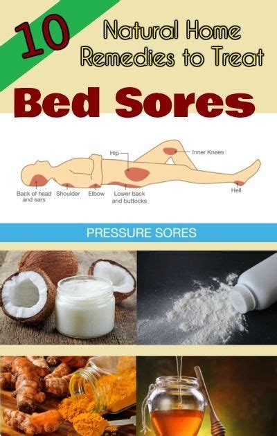 Home Remedies For Bed Sores On Buttocks Happy Yuu