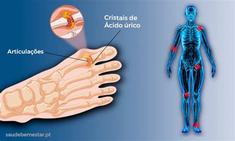 Sidra Acido Urico Alimentación Inteligente