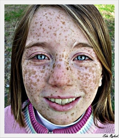 Taches De Rousseur Red Hair Freckles Women With Freckles Freckles