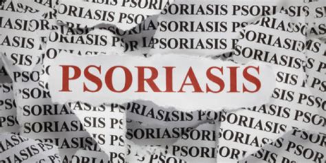 Its Not Contagious Psoriasis Awareness Month