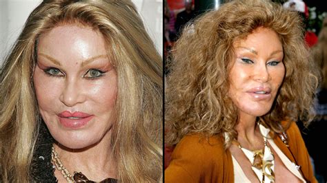 Catwoman Jocelyn Wildenstein Shares Photo To Prove Shes Never Had
