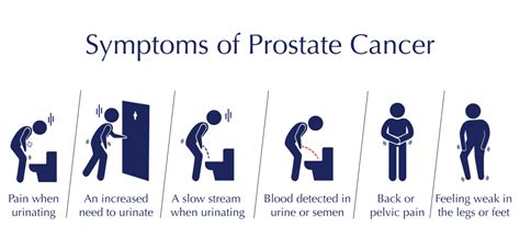 Prostate Cancer Causes