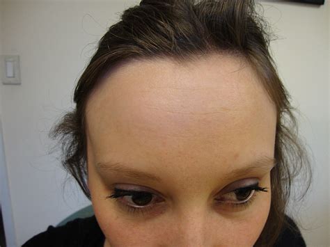 10 Fascinating Facts About Forehead