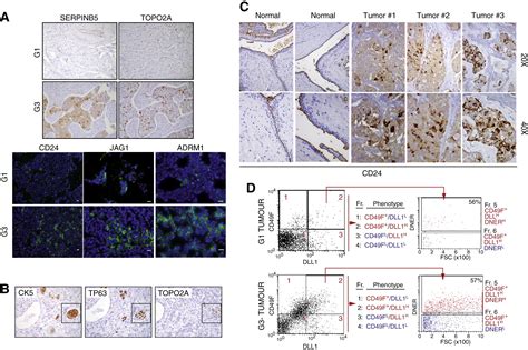 Biological And Molecular Heterogeneity Of Breast Cancers Correlates