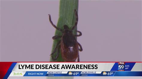 Protecting Yourself From Tick And Lyme Disease Youtube