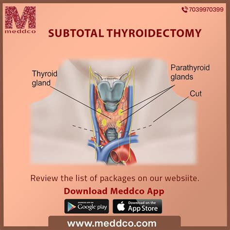 How To Prepare For A Subtotal Thyroidectomy Surgery