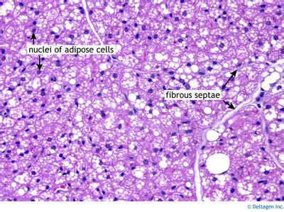 Adipose Tissue Histology Brown Adipose Tissue Labels Histology