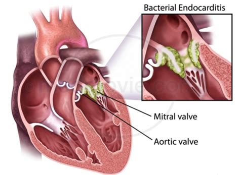 Pinterest Heart Valves Cardiovascular System Antifungal Medication