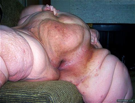Morbidly Obese Woman Naked