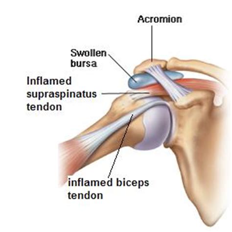 Deep to the rtc tendon insertions, blends with the capsule and supraspinatus to form part of the roof of the. Supraspinatus
