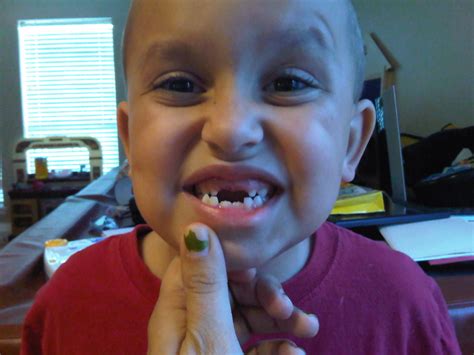 If your cat has red or bleeding gums, discolored teeth or mouth lesions, your vet should examine him right away. Colby | Colby shows off his missing teeth, April 2010. He ...