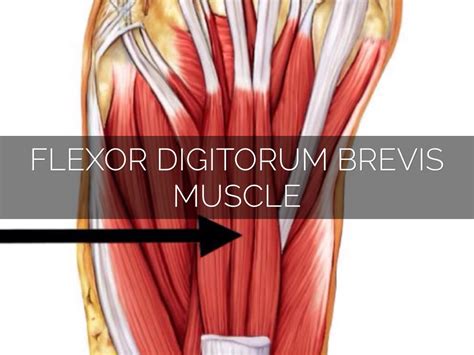 Ebraheim's educational animated video describes the anatomy and injury of the flexor tendons of the fingers. Anatomy Kickball by Jymeelah Kirk