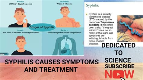 Syphilis Causes Symptoms And Treatment Youtube