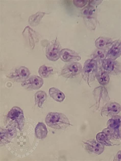 Giardia Duodenalis