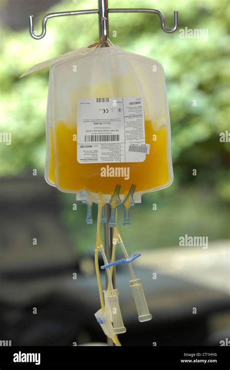 Blood Platelet Bags Hi Res Stock Photography And Images Alamy