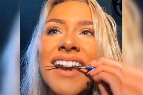 Dont Try This Tiktok Trend Dentists Warn Against Diy Teeth Filing