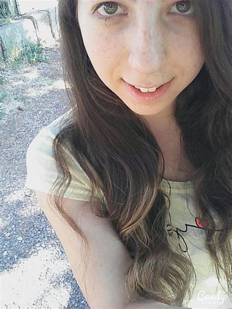 Çillerim yüzünden beni beğenmedi demiştim resimli soruyorum çok mu