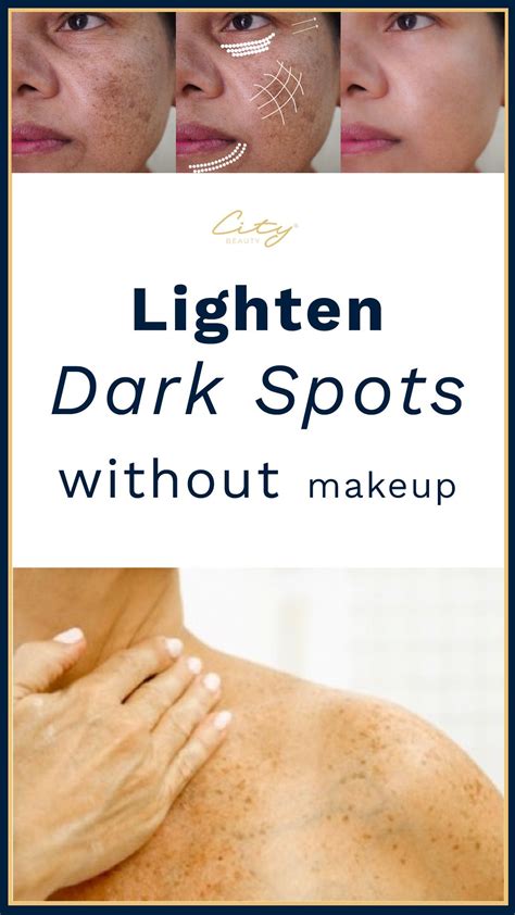 How To Fade Dark Spots Naturally Lighten Dark Spots How To Fade