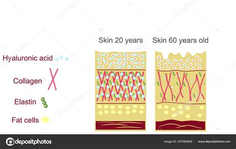 Anatomical Structure Skin Elastin Hyaluronic Acid Collagen Skin Aging