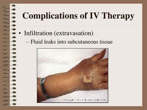 Ppt Pediatric Iv Therapy Powerpoint Presentation Free Download Id