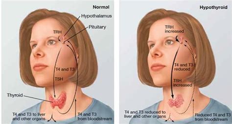 Thyroid Gland Must Known Facts Ayoti Blog