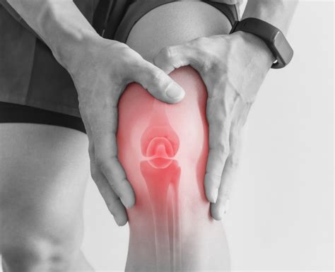 Knee Pain Location Chart Sexiz Pix
