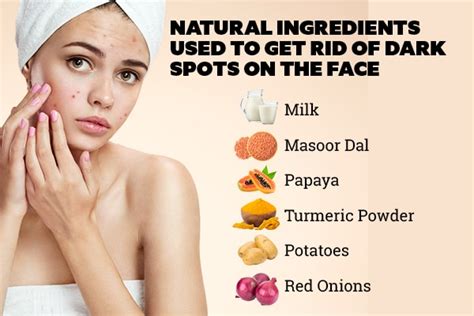 Natural Ways To Remove Brown Spots On Skin Removemania
