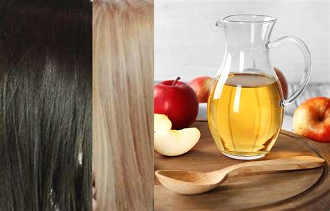 What are the causes of reversible patchy hair loss? Using Apple Cider Vinegar to Lighten Hair | Hairsentry