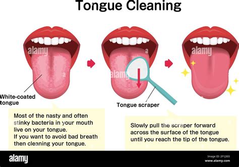 How To Clean Your Tongue Vector Illustration Halitosis Prevention Stock Vector Image And Art Alamy
