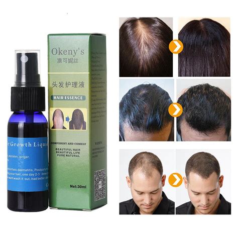 30ml Fast Growth Yuda Pilatory Spray Anti Baldness Hair