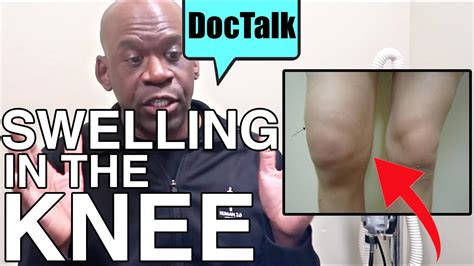 Swelling In The Knee Why You Get It And How To Treat It With Orthopedic Surgeon Dr Chris Raynor