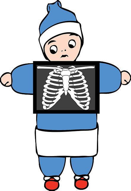 X Ray Anatomy Bone · Free Vector Graphic On Pixabay