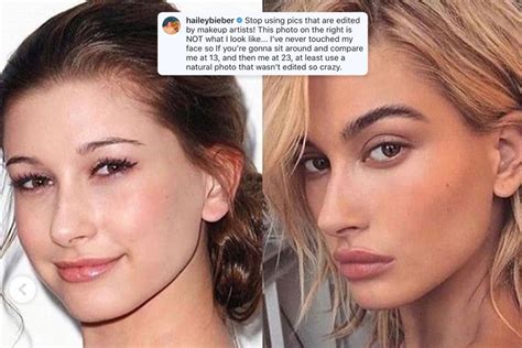 Hailey Baldwin Shuts Down Accusations She Got Plastic Surgery And Insists ‘i’ve Never Touched My