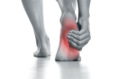 Plantar Fasciitis And Heel Spurs Podiatrist Nyc Downtown Step Up Footcare