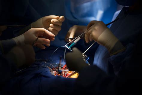 Remodeling The Annulus Mitral Valve Repair Center
