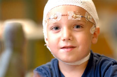 A seizure is a sudden rush of electrical activity in the brain. New study looks at academic outcomes of children following ...