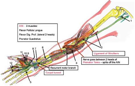 Ulnar Nerve Entrapment Sites