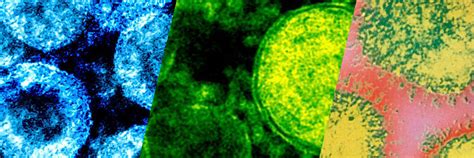 Check spelling or type a new query. Antygen COVID-19 SMI SARS MERS Influenza Economic ...