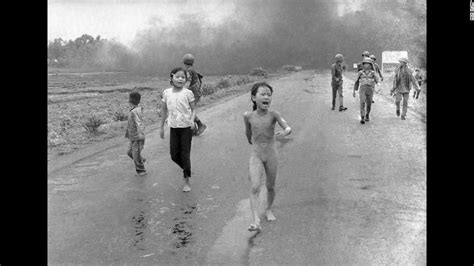 Girl From Iconic Vietnam Photo Begins New Treatment Cnn