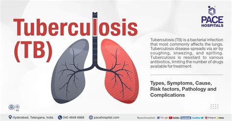 Tuberculosis Symptoms Types Causes Risk Factors Prevention