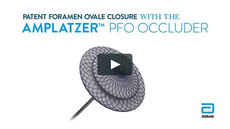 Patent Foramen Ovale Closure Amplatzer Pfo Occluder On Vimeo