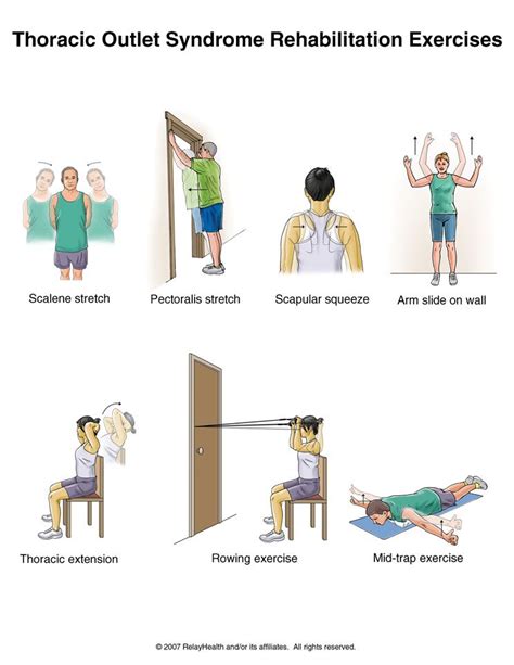 Thoracic Outlet Syndrome Rehabilitation Exercises Thoracic Outlet