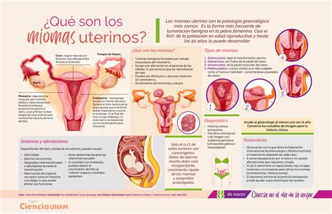 Especial Día de la Mujer Miomas en el útero Ciencia UNAM