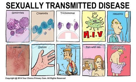 Illustrationstd Sexually Transmitted Diseases