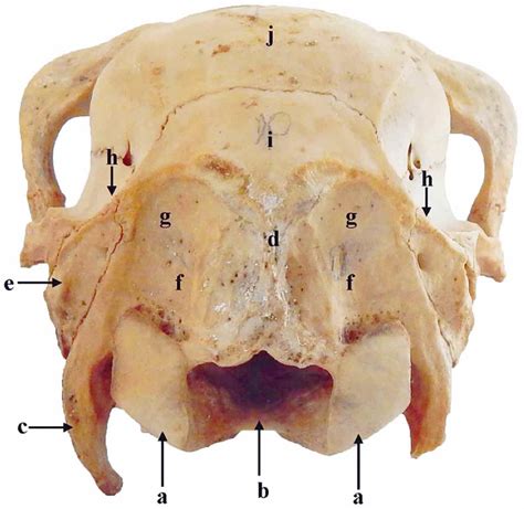 Nuchal View Of Skull Showing Occipital Condyle A Foramen Magnum B