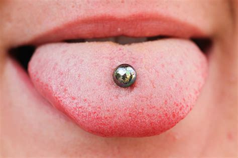 the dental dangers of getting your tongue pierced