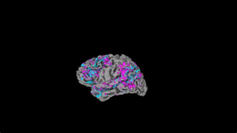 Researchers Use A I To Decode Words From Brain Scans Smithsonian
