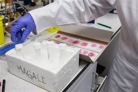 What is prostate cancer screening? The Spread of Prostate Cancer - Prostate Cancer Research